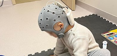 Pełnoczepkowe badanie mózgu - nowoczesne narzędzie dostępne w CNR Rutkowscy-23085